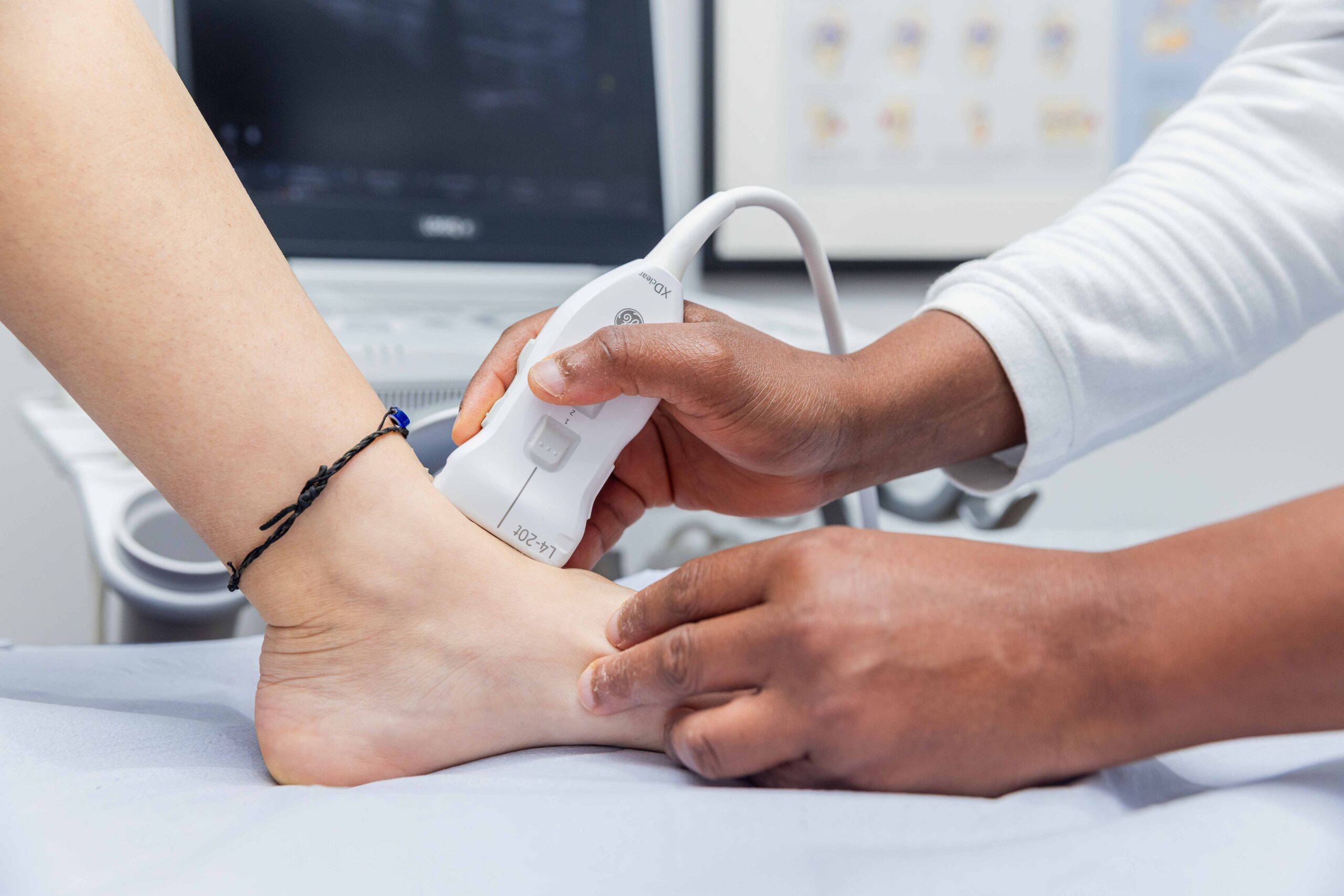 Ultrasound scan the common forefoot conditions