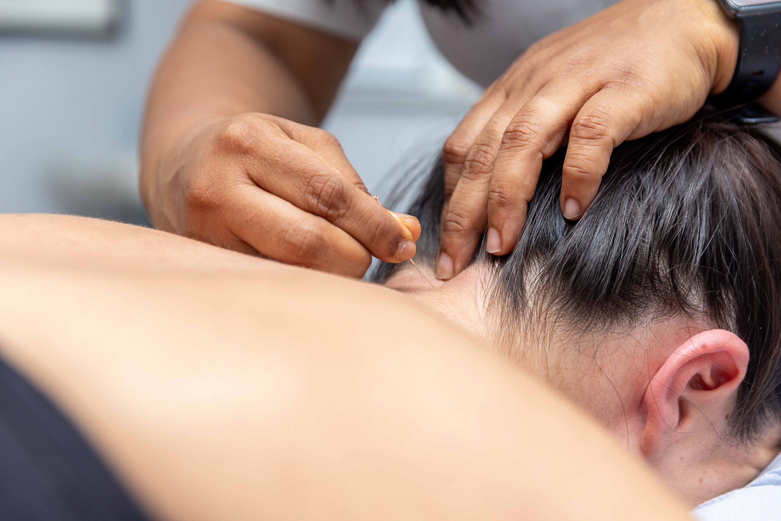 Acupuncture in Wandsworth