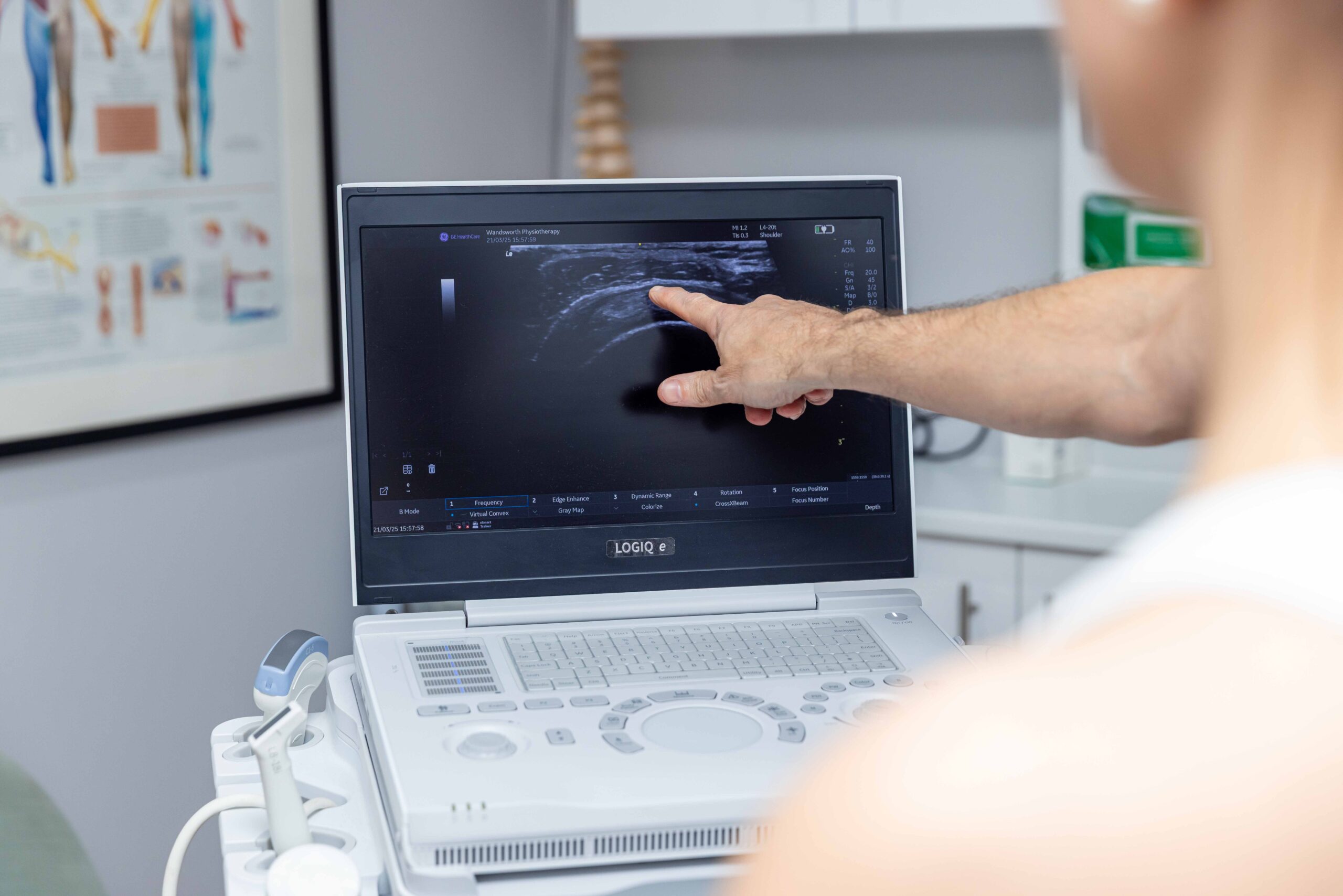 MSK diagnostic ultrasound scan